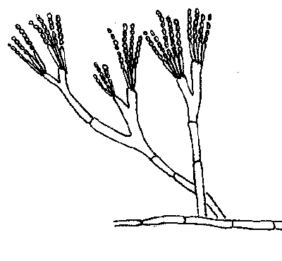 Schimmel: Pinselschimmel (Pinicillium italica)